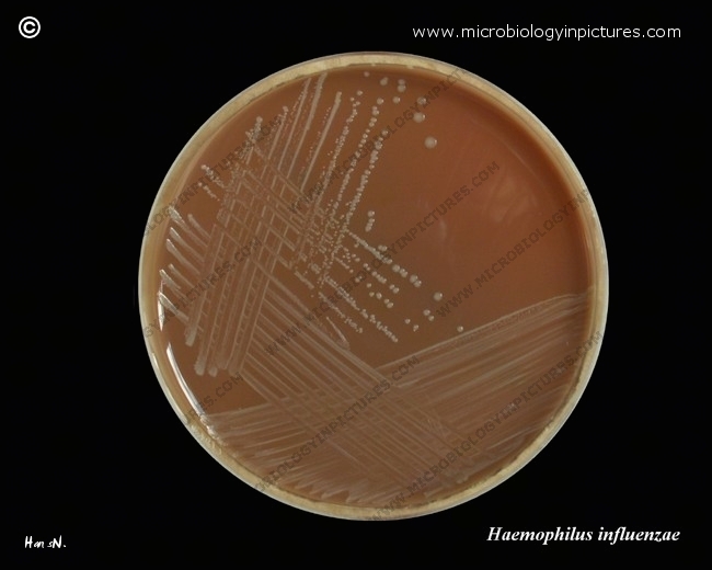 haemophilus influenzae